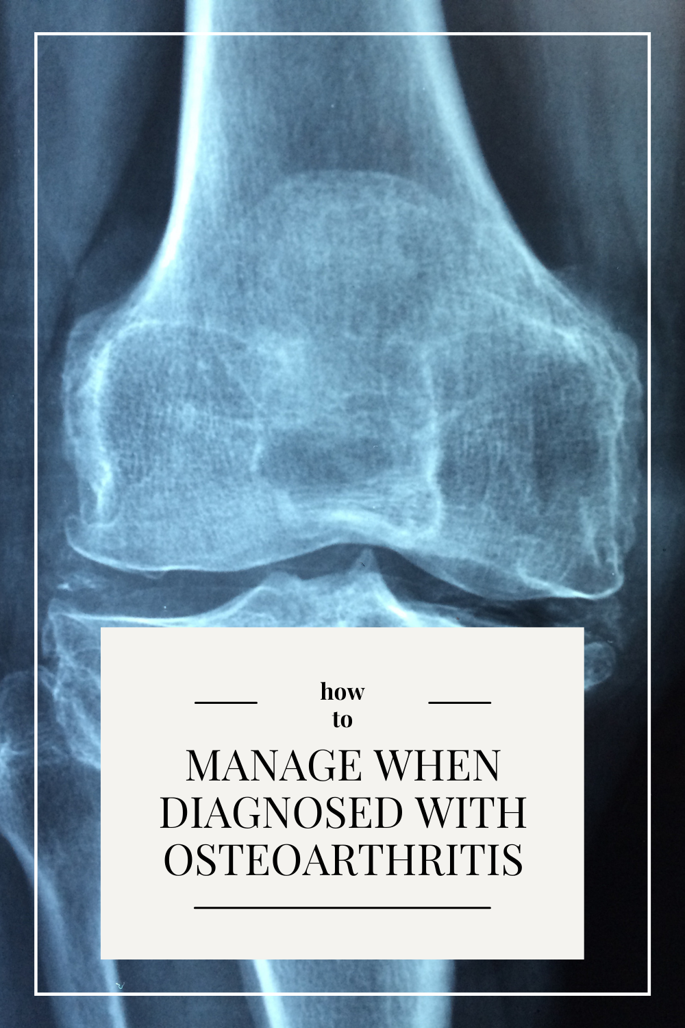 How to Manage Your Lifestyle When Diagnosed with Osteoarthritis